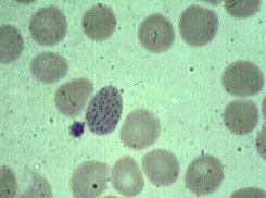 Basophilic stippling in red blood cells