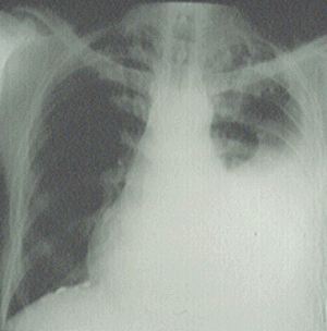 chest radiograph